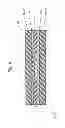 Fig. 11 - Connecting arrangement for connecting a fiber composite component to a second component