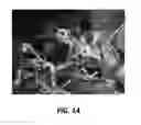 Fig. 15 - Variable resistance serial hybrid electric bicycle