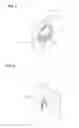 Fig. 04 - ELECTRICAL CIRCUIT SWITCHING DEVICE