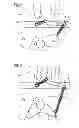 Fig. 04 - Locking mechanism for a switch-on button of a circuit breaker