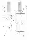 Fig. 03 - Gas diffuser ion inlet
