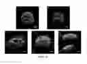 Fig. 10 - Apparatus and methodology for flow fluorescence microscopic imaging