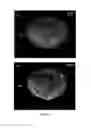 Fig. 14 - Apparatus and methodology for flow fluorescence microscopic imaging