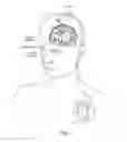Fig. 02 - Medical stimulation device providing non-regular electrical stimulation patterns for treating neurological disorders