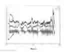 Fig. 04 - System and method for deceleration detection and signaling in vehicles