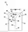 Fig. 01 - Lobe antenna