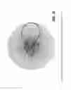 Fig. 17 - Antenna system providing simultaneously identical main beam radiation characteristics for independent polarizations