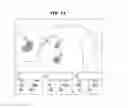 Fig. 12 - Ultrasonic image processing apparatus and method