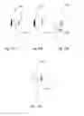 Fig. 22 - Devices and methods of sensing combined ultrasonic and infrared signal