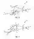 Fig. 03 - Apparatus and method for multi-spectral dual balanced imaging