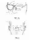 Fig. 03 - Article support device for applying to skin