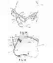 Fig. 09 - Article support device for applying to skin