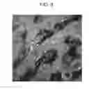 Fig. 08 - Test apparatus and method of observing biopsy specimen sampled by using test apparatus