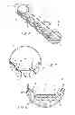 Fig. 04 - Electric Shock Resistant L.E.D. Based Light