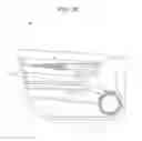 Fig. 04 - Vehicle decorative component and vehicle decorative component installing method