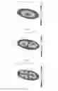 Fig. 06 - HEADPHONES AND HEADPHONE DRIVER