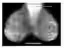 Fig. 01 - Apparatus and method for utilizing mammogram images for verification