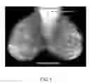 Fig. 02 - Apparatus and method for utilizing mammogram images for verification