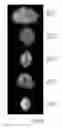 Fig. 03 - Apparatus and method for utilizing mammogram images for verification