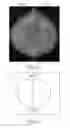Fig. 04 - Apparatus and method for utilizing mammogram images for verification