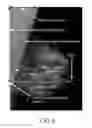 Fig. 07 - Apparatus and method for utilizing mammogram images for verification
