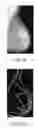 Fig. 09 - Apparatus and method for utilizing mammogram images for verification