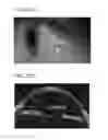 Fig. 23 - Frontal view reconstruction for iris recognition