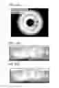 Fig. 24 - Frontal view reconstruction for iris recognition