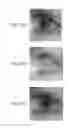 Fig. 28 - Frontal view reconstruction for iris recognition
