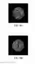 Fig. 09 - SYSTEM AND METHOD OF USING IMPRINT ANALYSIS IN PILL IDENTIFICATION