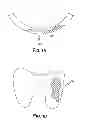Fig. 05 - Methods of Predicting Musculoskeletal Disease