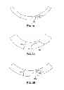 Fig. 06 - Methods of Predicting Musculoskeletal Disease