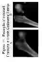 Fig. 32 - Methods of Predicting Musculoskeletal Disease