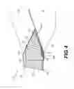 Fig. 05 - Berm and method of construction thereof