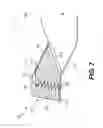 Fig. 08 - Berm and method of construction thereof