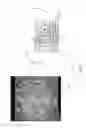 Fig. 06 - GRAIN MICROSTRUCTURE IN DAMPERS OF GAS TURBINE ENGINE