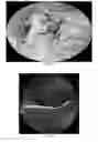 Fig. 03 - FLUORESCENT COMPOSITIONS WITH ENHANCED FLUORESCENCE AND METHODS BASED THEREON