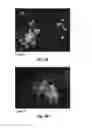 Fig. 09 - INJECTABLE CNS-DERIVED ECM FOR TISSUE RECONSTRUCTION