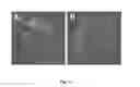 Fig. 15 - INJECTABLE CNS-DERIVED ECM FOR TISSUE RECONSTRUCTION