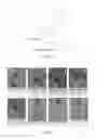 Fig. 06 - Methods for improved wound closure employing olivamine and endothelial cells