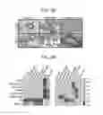 Fig. 14 - Combination therapy to prevent DCIS formation and progression to breast cancer