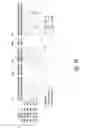 Fig. 10 - IL-17 RECEPTOR A  ANTIGEN BINDING PROTEINS