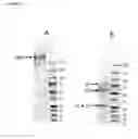 Fig. 09 - Anti-TNF alpha monoclonal secretory IgA antibodies and methods for treating inflammatory diseases