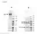 Fig. 10 - Anti-TNF alpha monoclonal secretory IgA antibodies and methods for treating inflammatory diseases