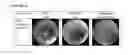 Fig. 16 - Anti-TNF alpha monoclonal secretory IgA antibodies and methods for treating inflammatory diseases