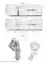 Fig. 14 - Method of target membrane protein depletion
