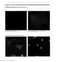 Fig. 28 - APPLICATIONS OF AN IMMUNE SYSTEM-RELEASED ACTIVATING AGENT (ISRAA)
