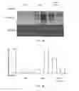 Fig. 04 - METHODS FOR TREATMENT OF MUSCULAR DYSTROPHY