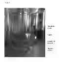 Fig. 09 - Pharmaceutical formulation