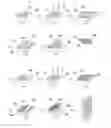 Fig. 01 - Electronic device case and surface treatment method thereof